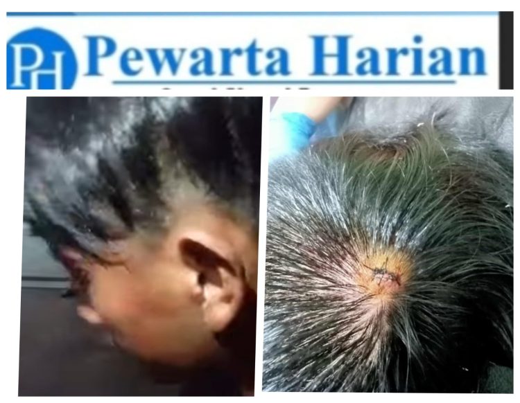 SPBU Milik Orang Nomor Satu di Mitra Diduga Jadi Sarang Mafia Solar: Sopir Truk Jadi Korban Penganiayaan